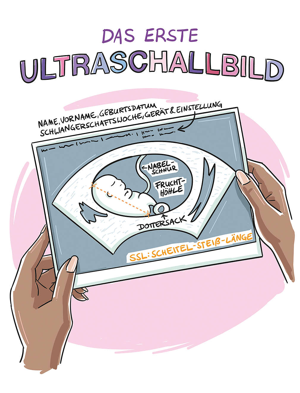 Abbildung: Das erste Ultraschallbild
