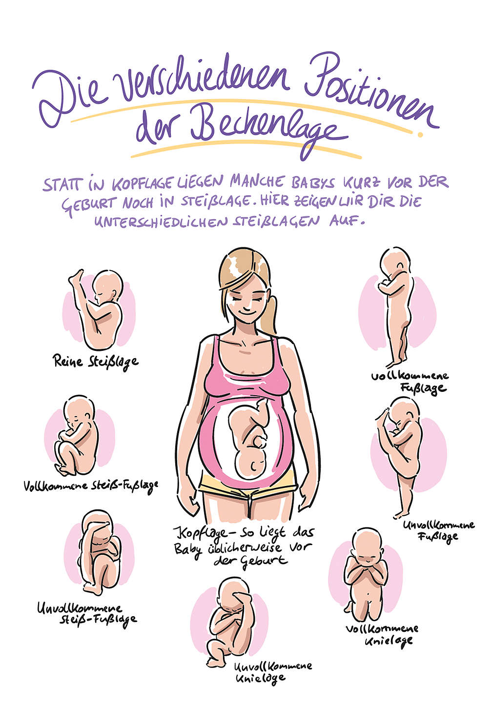 Abbildung „Die verschiedenen Positionen der Beckenlage"