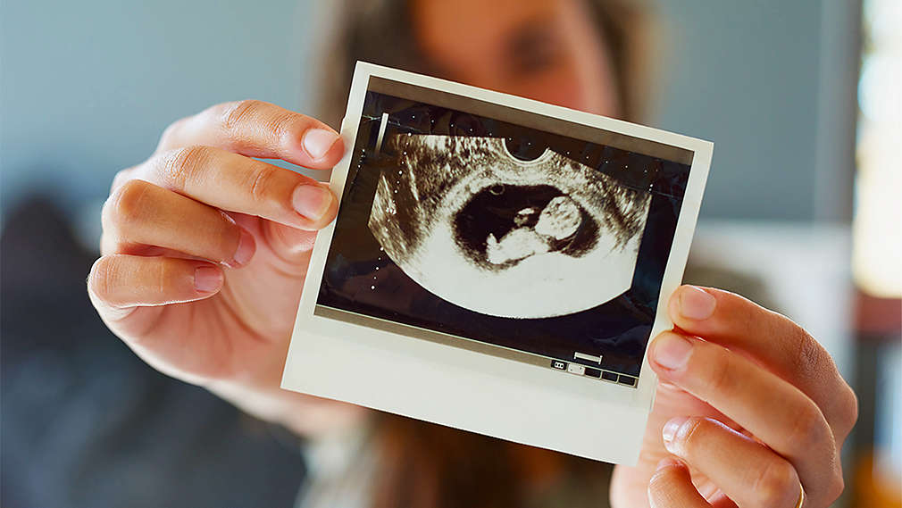 Žena čije se lice mutno vidi samo u pozadini drži sliku s ultrazvuka pred kamerom.