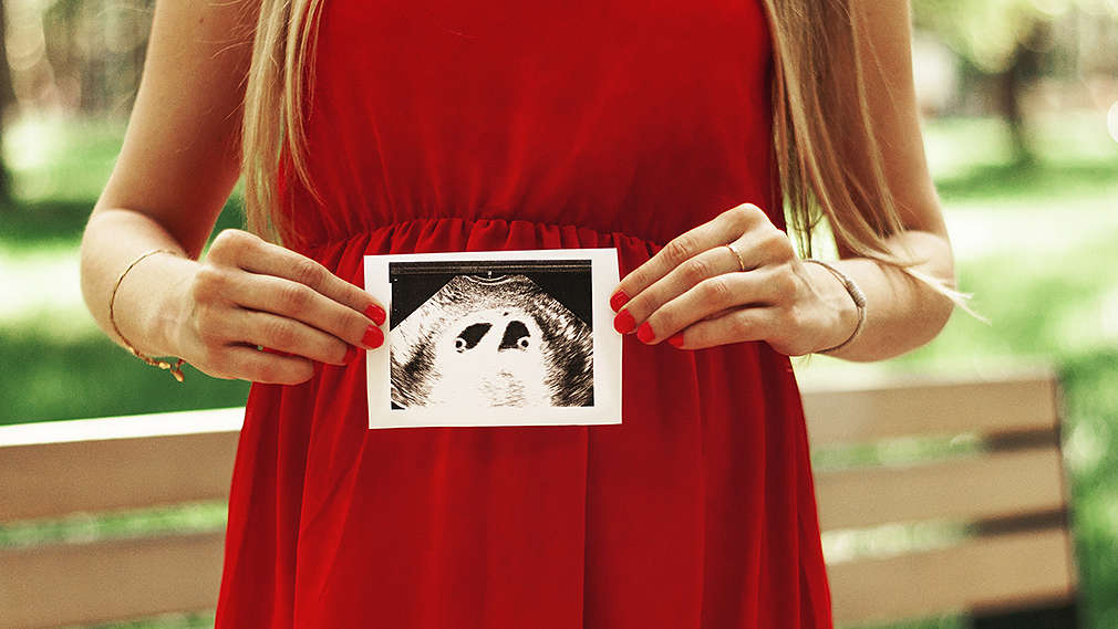 Frau mit Ultraschallbild von Zwillingen