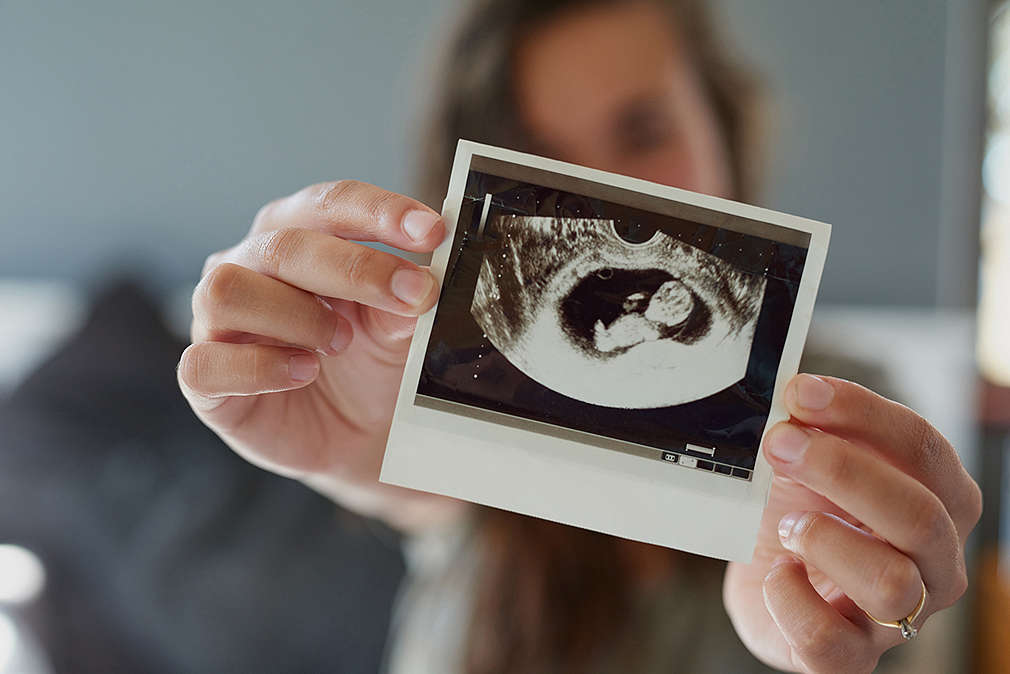 Изображение на млада жена, която показва снимка на бебе от ултразвук